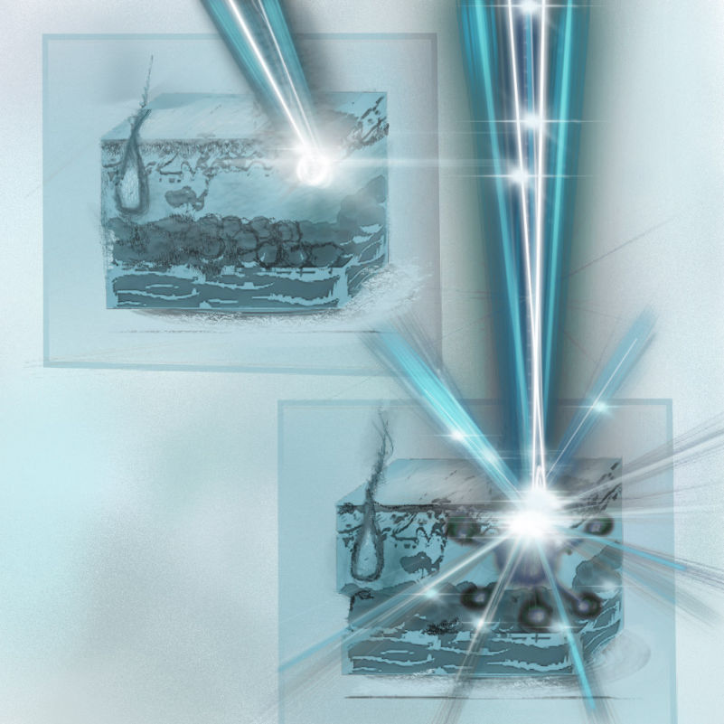 Photodynamische Therapie